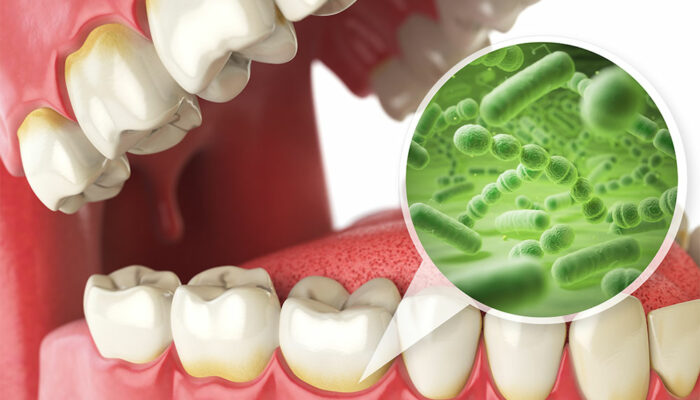 3 edibles that are beneficial for oral health