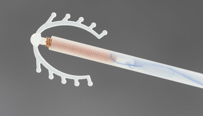 Common IUD side effects and how to tackle them