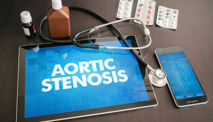 Aortic stenosis- Symptoms, diagnosis, and management