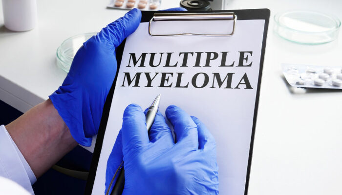 10 warning signs for the onset of multiple myeloma