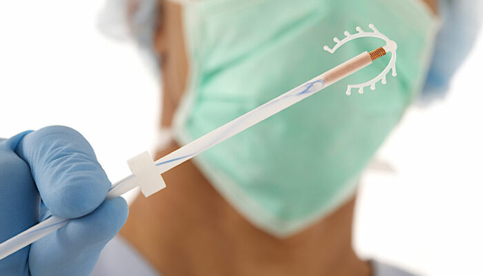 6 common myths about IUD debunked