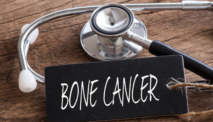 7 early signs of bone cancer