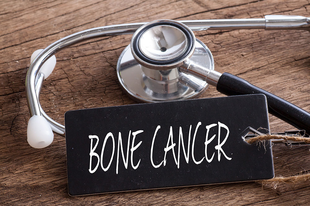 7 early signs of bone cancer