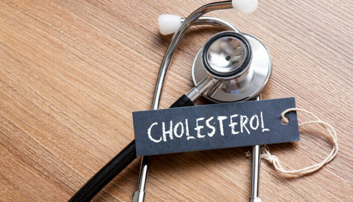 Signs and risk factors of increasing levels of cholesterol