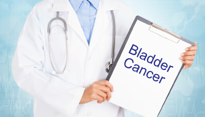 6 early warning signs of bladder cancer