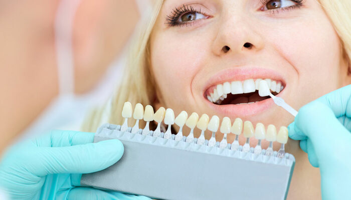 6 common dental implant mistakes and how to avoid them