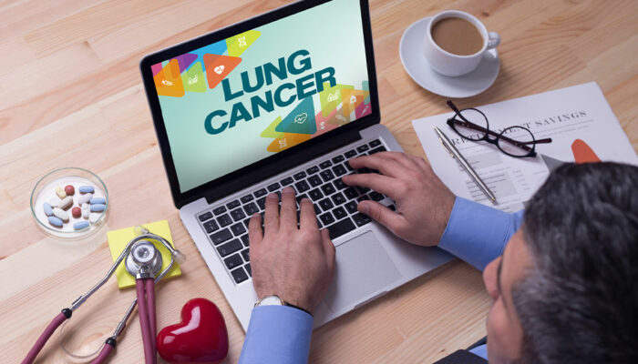 3 tips to manage lung cancer