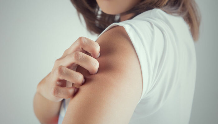 10 common signs of itchy skin