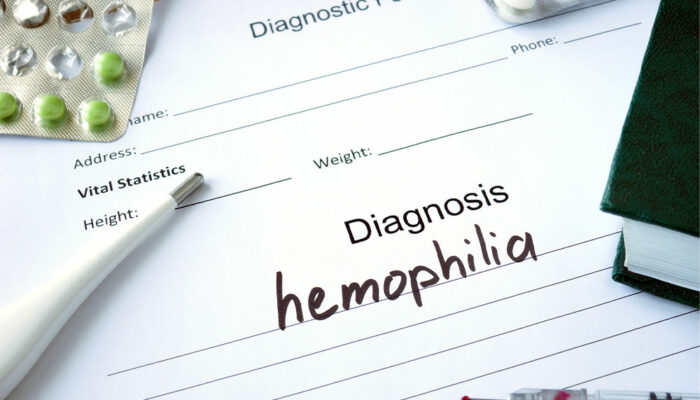 4 essential tips for healthy living with hemophilia