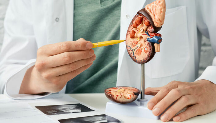 4 signs of kidney disease due to excess sugar consumption