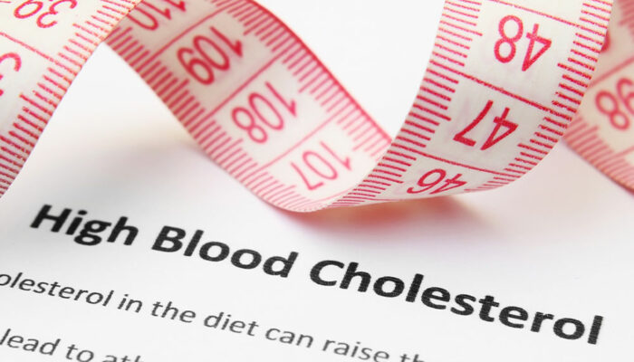 5 signs indicative of high cholesterol levels in the body