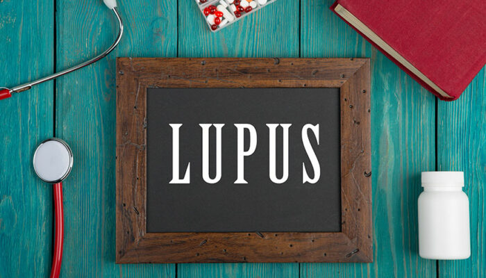 5 triggering factors of lupus to avoid