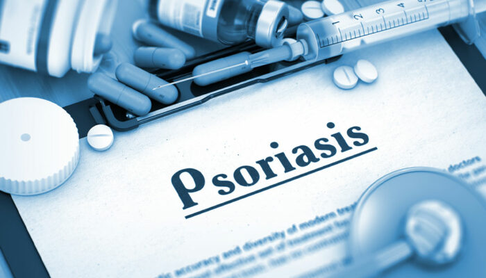 6 common health conditions linked to psoriasis