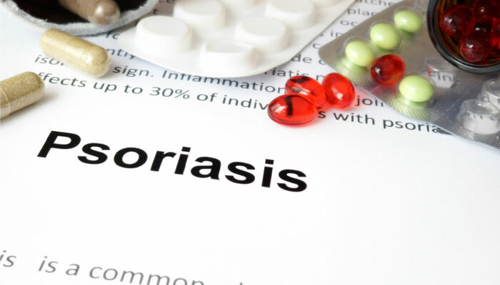 6 common health conditions related to psoriasis