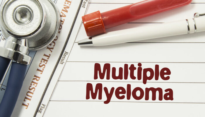 6 early signs of multiple myeloma