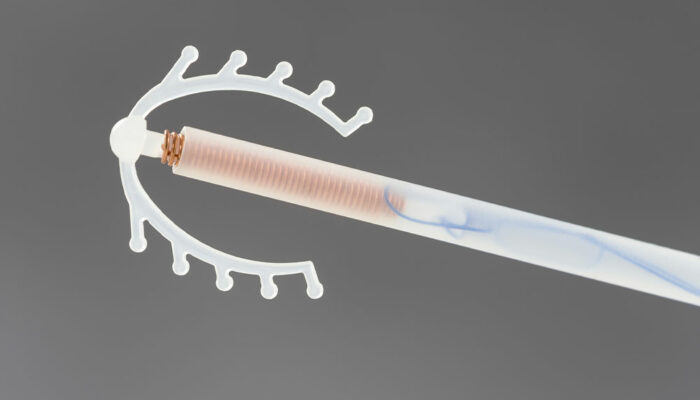 6 tips for dealing with IUD side effects