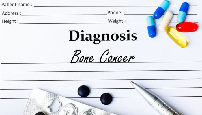 9 warning signs that indicate bone cancer