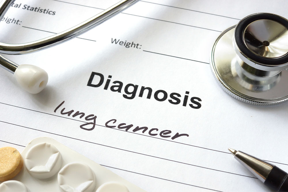 Common signs of lung cancer that should not be ignored