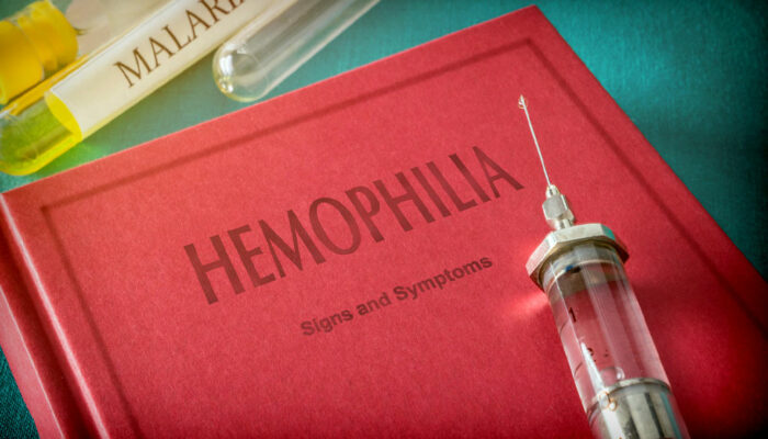 Hemophilia &#8211; Symptoms to look out for