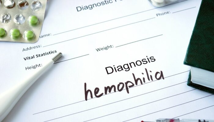 Here&#8217;s what to eat for hemophilia