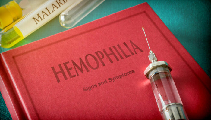 Travel precautions for hemophilia A patients