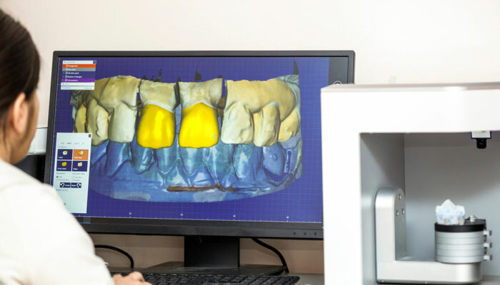 5 things to consider when choosing dental practice software